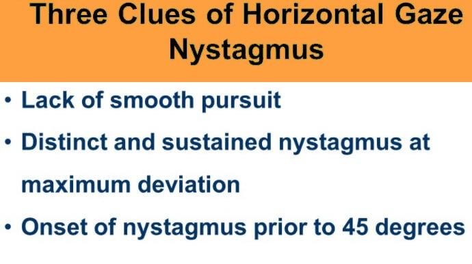 Clues of Horizontal Gaze Nystagmus