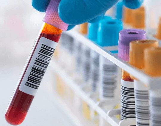 Blood test tube for weed drug test