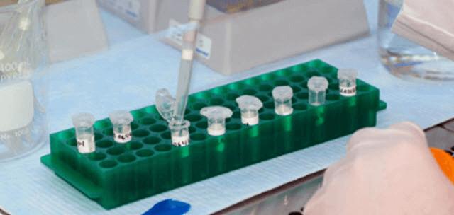 Blood Test Alcohol Drugs