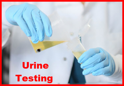 Urine Testing